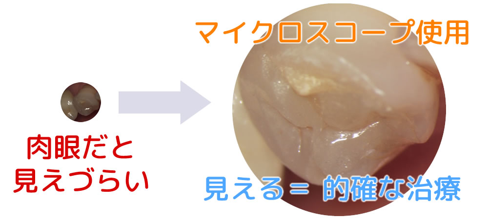 歯科マイクロスコープ